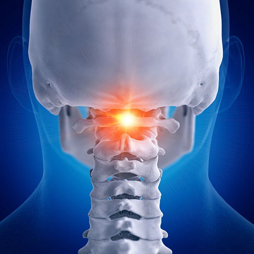 Stinson Chiropractic Clinic - Atlas Vertebrae